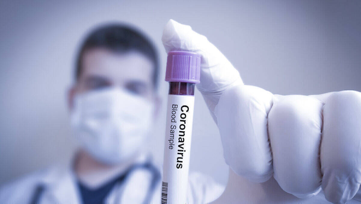 Dem Coronavirus auf der Spur – ein kleines Schmuckstück soll helfen.